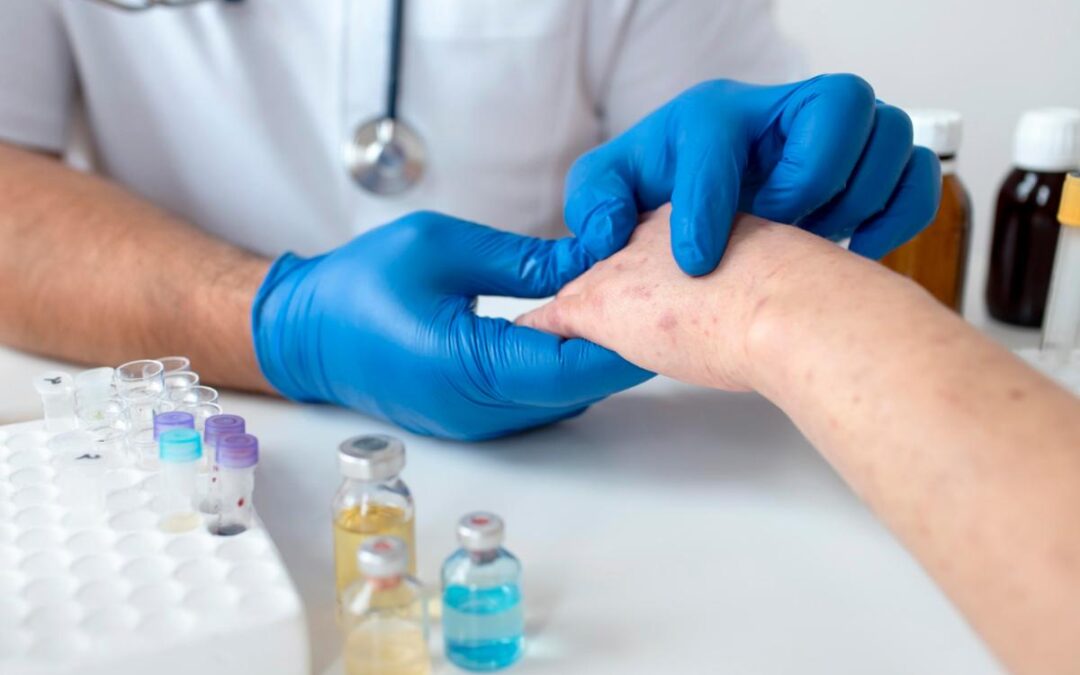 Five Steps to Take after Learning You Have Skin Cancer