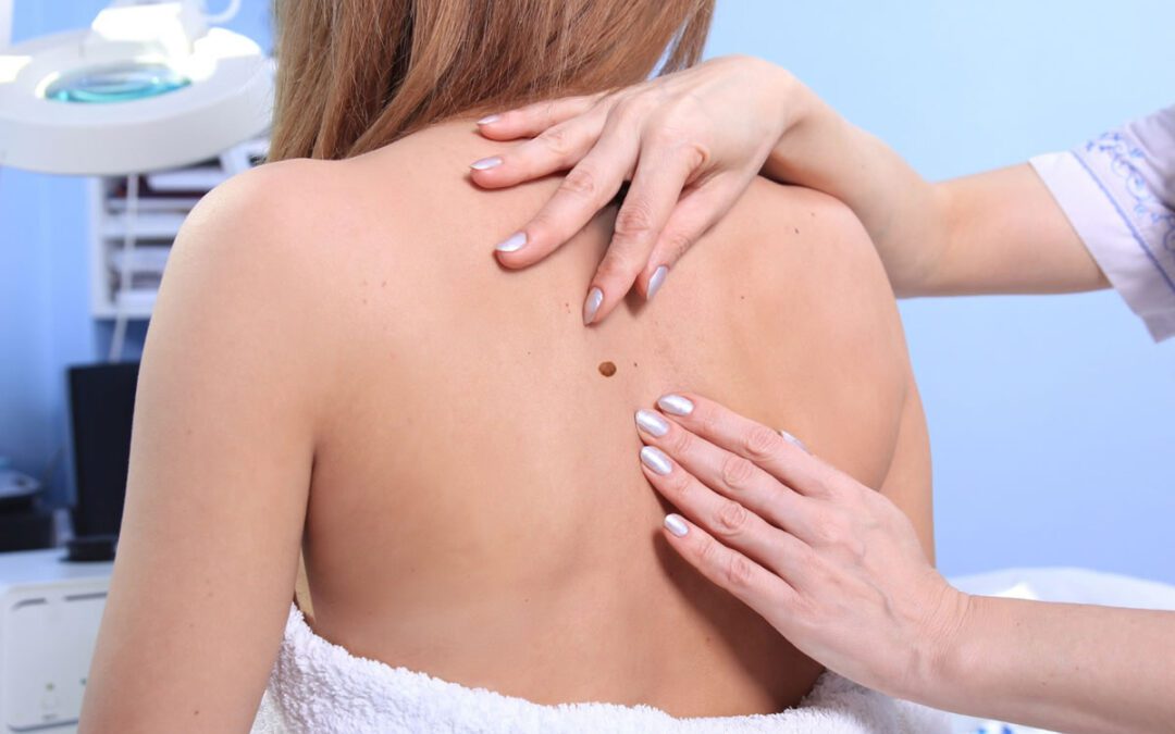 Why You May Need to Have a Skin Biopsy Test Done