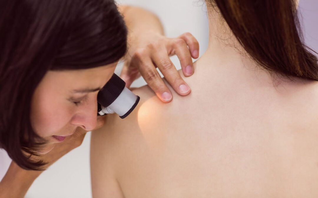 Why You Need to Prioritize Skin Checks